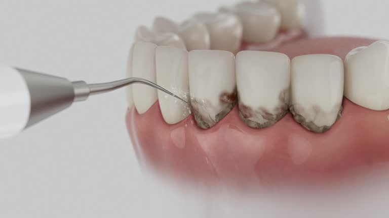 Trusted Tooth Extraction service in Keys, OK - Dentist Open Now